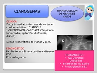 CIANOGENAS TRANSPOSICION
DE GRANDES
VASOS
CLINICA
Datos inmediatos despues de cortar el
cordon umbilica ::CIANOSIS
INSUFICIENCIA CARDIACA (Taquipnea,
taquicardia, agitación, diaforesis,
disnea)
Dedos Hipocráticos de Manos y pies.
DIAGNOSTICO
Rx. De tórax (Silueta cardiaca «Huevo»)
ECG
Ecocardiograma.
TRATAMIENTO:
• QX Diuretico
• Digitalicos
• Bicarbonato de Sodio
• Prostaglandina E1
 