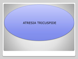 ATRESIA TRICUSPIDE
 