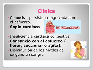 Clínica
 Cianosis : persistente agravada con
el esfuerzo.
 Soplo cardiaco
 Insuficiencia cardiaca congestiva
 Cansancio con el esfuerzo (
llorar, succionar o agita).
 Disminución de los niveles de
oxigeno en sangre
 