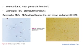 URINE Sediment Analysis in Clinical Pathology | PPTX