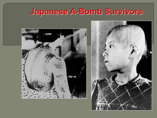 Japanese A-Bomb Survivors
 