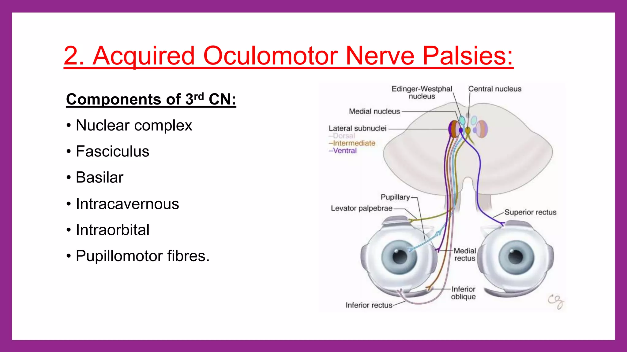 Ocular nerve palsy - 3rd, 4th and 6th cranial nerve palsy | PPTX