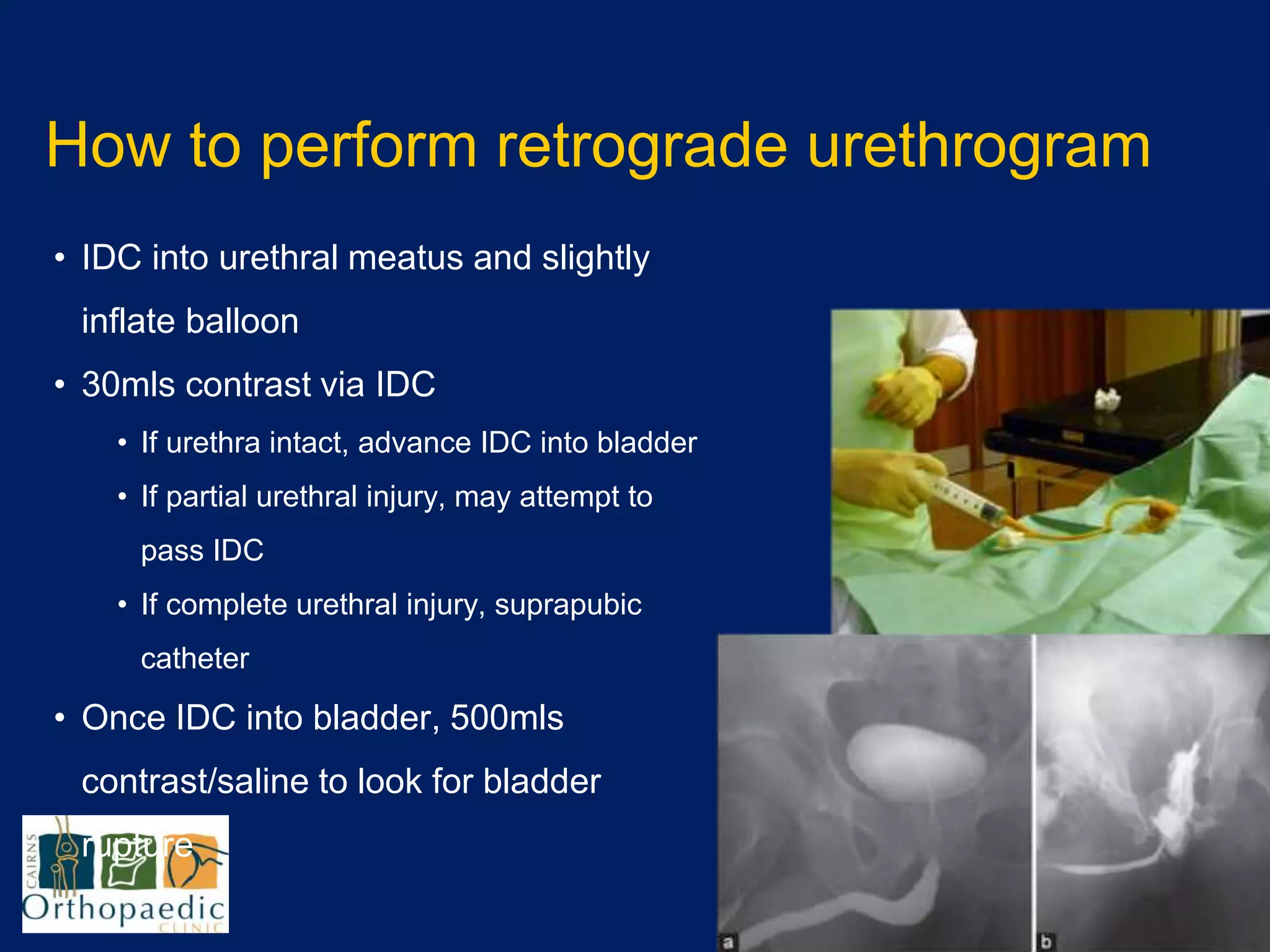 Pelvis by Dr Ben Parkinson | PPTX