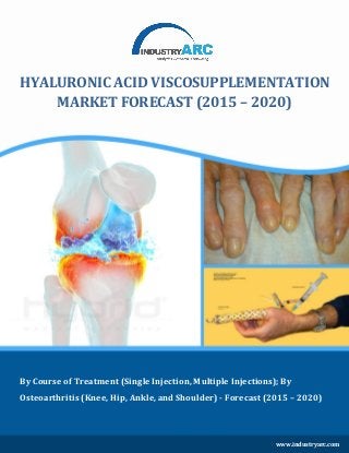 By Course of Treatment (Single Injection, Multiple Injections); By
Osteoarthritis (Knee, Hip, Ankle, and Shoulder) - Forecast (2015 – 2020)
HYALURONIC ACID VISCOSUPPLEMENTATION
MARKET FORECAST (2015 – 2020)
www.industryarc.com
 