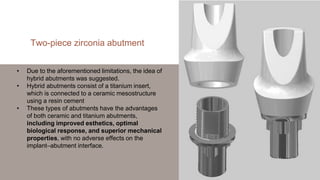 • Due to the aforementioned limitations, the idea of
hybrid abutments was suggested.
• Hybrid abutments consist of a titan...