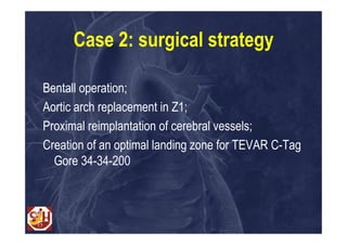 Case 2: surgical strategy

Bentall operation;
Aortic arch replacement in Z1;
Proximal reimplantation of cerebral vessels;
Creation of an optimal landing zone for TEVAR C-Tag
  Gore 34-34-200
 