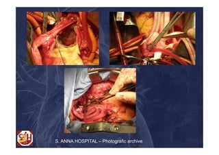 S. ANNA HOSPITAL – Photografic archive
 