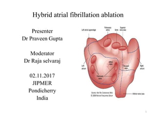 Hybrid atrial fibrillation ablation
Presenter
Dr Praveen Gupta
Moderator
Dr Raja selvaraj
02.11.2017
JIPMER
Pondicherry
India
1
 
