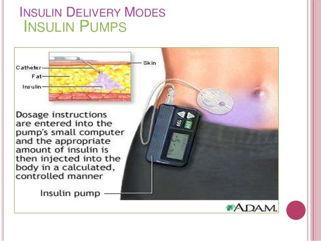 Hybrid closed loop insulin delivery systemArtificial