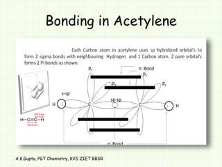 Bonding in Acetylene
A.K.Gupta, PGT Chemistry, KVS ZIET BBSR
 