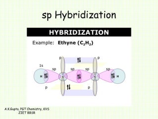 sp Hybridization
A.K.Gupta, PGT Chemistry, KVS
ZIET BBSR
 