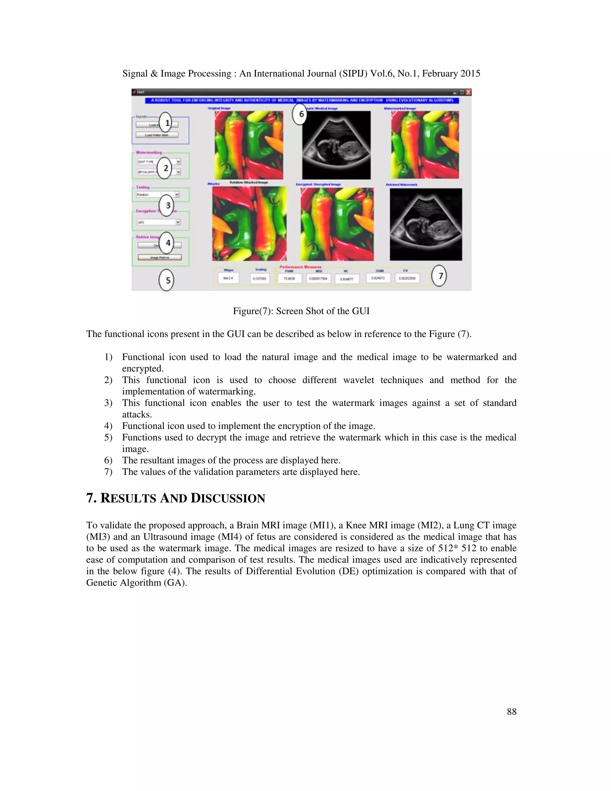Signal & Image Processing : An International Journal (SIPIJ) Vol.6, No.1, February 2015 88 Figure(7): Screen Shot of the GUI The functional icons present in the GUI can be described as below in reference to the Figure (7). 1) Functional icon used to load the natural image and the medical image to be watermarked and encrypted. 2) This functional icon is used to choose different wavelet techniques and method for the implementation of watermarking. 3) This functional icon enables the user to test the watermark images against a set of standard attacks. 4) Functional icon used to implement the encryption of the image. 5) Functions used to decrypt the image and retrieve the watermark which in this case is the medical image. 6) The resultant images of the process are displayed here. 7) The values of the validation parameters arte displayed here. 7. RESULTS AND DISCUSSION To validate the proposed approach, a Brain MRI image (MI1), a Knee MRI image (MI2), a Lung CT image (MI3) and an Ultrasound image (MI4) of fetus are considered is considered as the medical image that has to be used as the watermark image. The medical images are resized to have a size of 512* 512 to enable ease of computation and comparison of test results. The medical images used are indicatively represented in the below figure (4). The results of Differential Evolution (DE) optimization is compared with that of Genetic Algorithm (GA). 