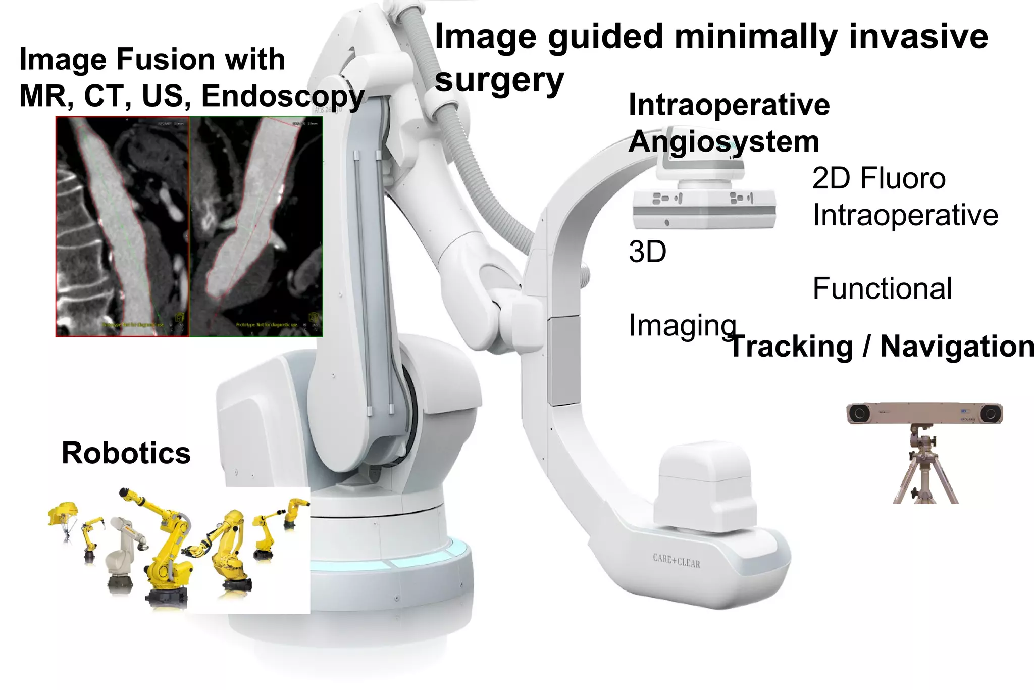 Image guided minimally invasive
surgery
Intraoperative
Angiosystem
2D Fluoro
Intraoperative
3D
Functional
Imaging
Robotics
Image Fusion with
MR, CT, US, Endoscopy
Tracking / Navigation
 