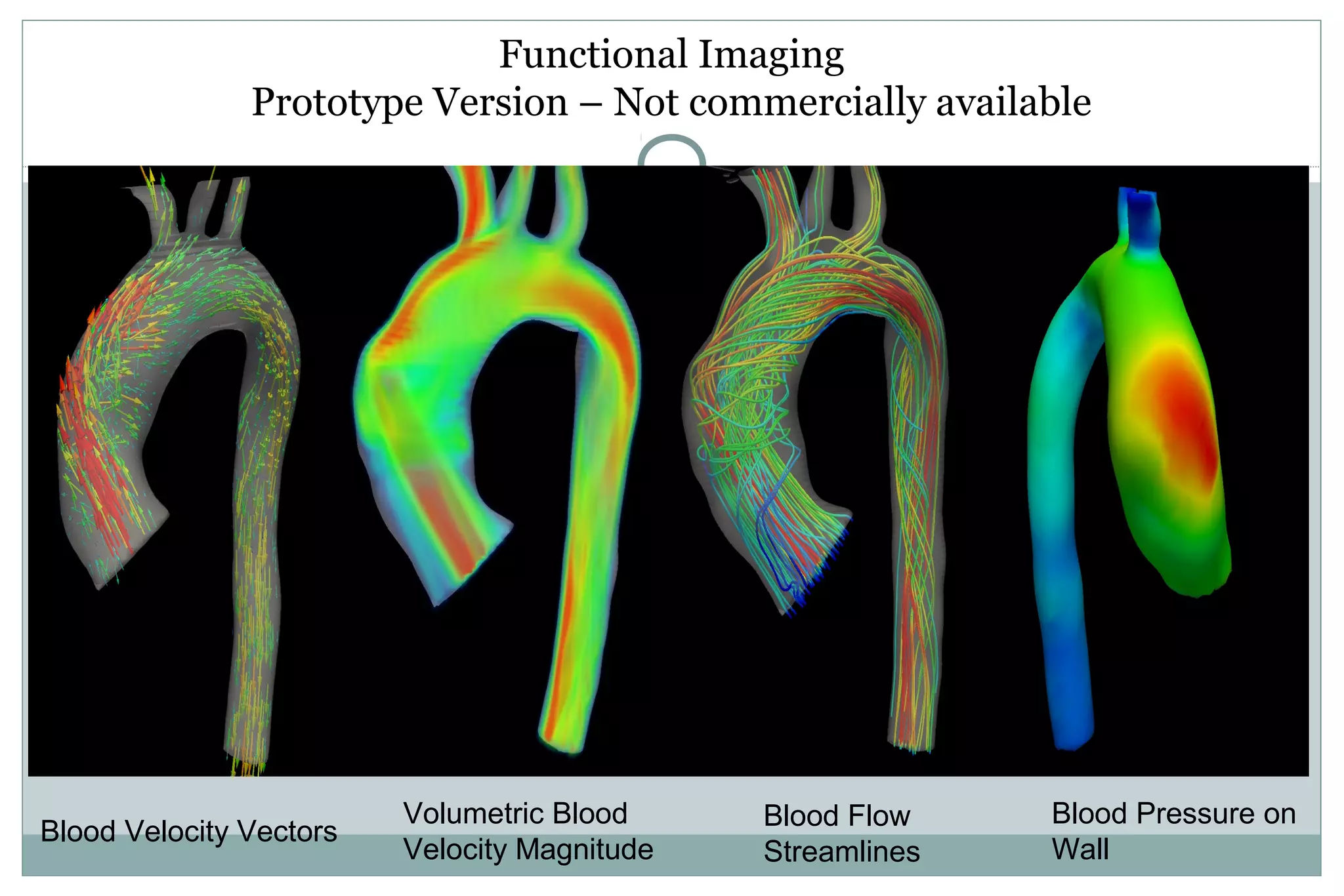 Functional Imaging
Prototype Version – Not commercially available
Blood Velocity Vectors
Volumetric Blood
Velocity Magnitude
Blood Pressure on
Wall
Blood Flow
Streamlines
 