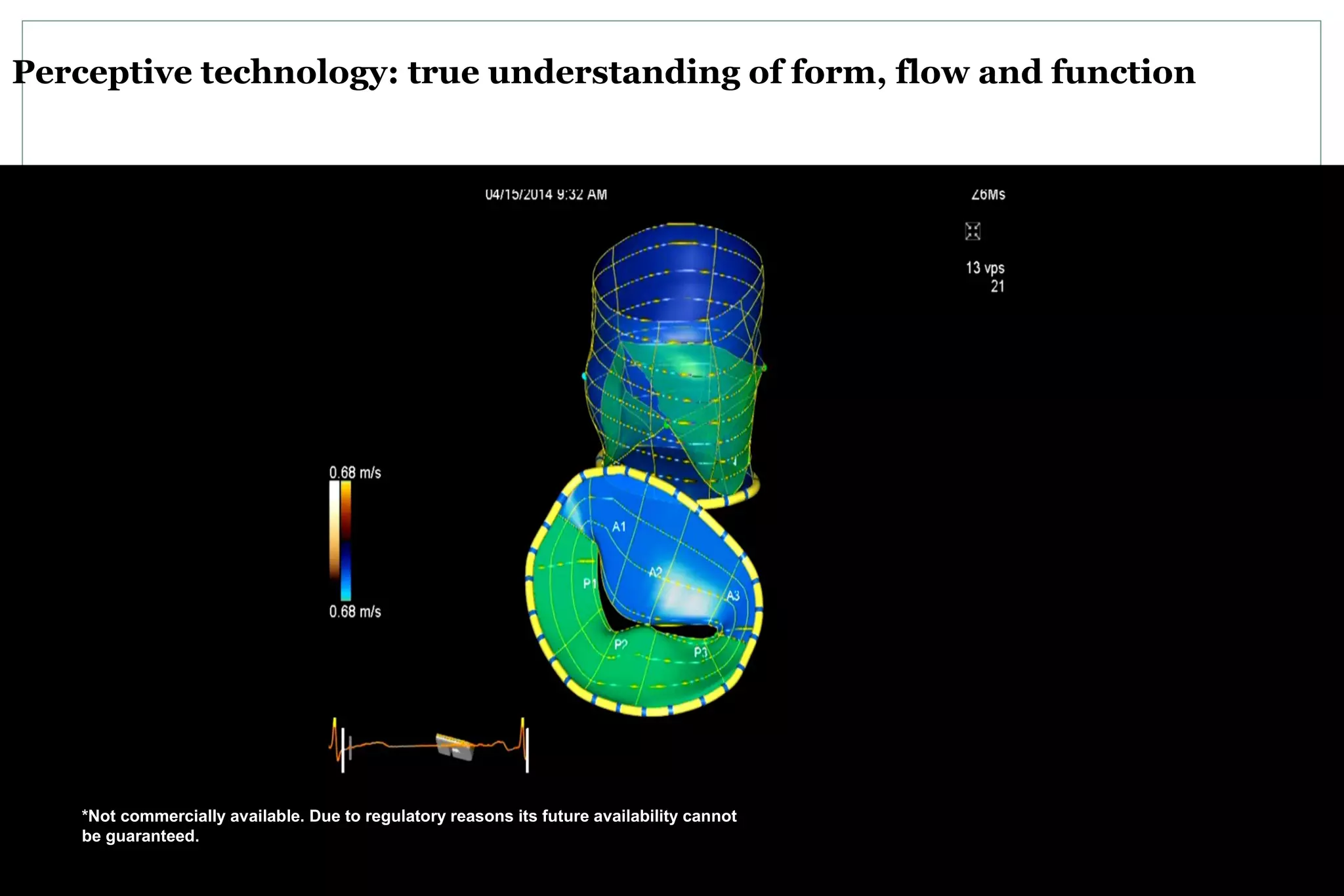 Perceptive technology: true understanding of form, flow and function
*Not commercially available. Due to regulatory reasons its future availability cannot
be guaranteed.
 
