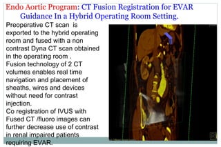 Hybrid operating room overview | PPT