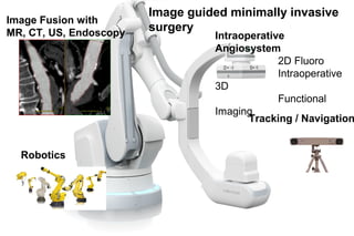 Image guided minimally invasive
surgery
Intraoperative
Angiosystem
2D Fluoro
Intraoperative
3D
Functional
Imaging
Robotics
Image Fusion with
MR, CT, US, Endoscopy
Tracking / Navigation
 