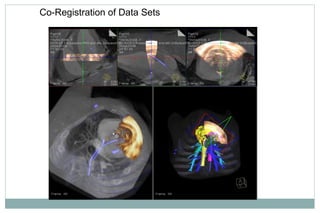 Co-Registration of Data Sets
 