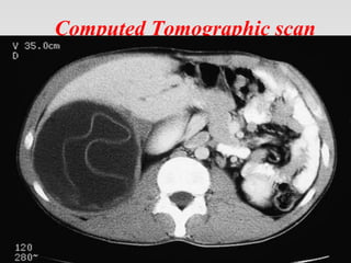 Computed Tomographic scan
 