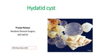 Hydatid cyst
Pranjal Rokaya
Resident General Surgery
KIST MCTH
29th December, 2022
 
