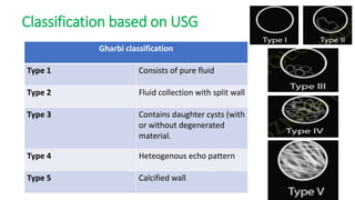 Classification based on USG
Gharbi classification
Type 1 Consists of pure fluid
Type 2 Fluid collection with split wall
Type 3 Contains daughter cysts (with
or without degenerated
material.
Type 4 Heteogenous echo pattern
Type 5 Calcified wall
 