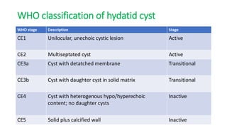 WHO classification of hydatid cyst
WHO stage Description Stage
CE1 Unilocular, unechoic cystic lesion Active
CE2 Multiseptated cyst Active
CE3a Cyst with detatched membrane Transitional
CE3b Cyst with daughter cyst in solid matrix Transitional
CE4 Cyst with heterogenous hypo/hyperechoic
content; no daughter cysts
Inactive
CE5 Solid plus calcified wall Inactive
 