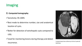 Imaging
2. Computed tomography
Sensitivity: 95-100%
Best mode to determine number, size and anatomical
location of cysts.
Better for detection of extrahepatic cysts compared to
USG.
Used for monitoring lesions during therapy and detect
recurrence.
 