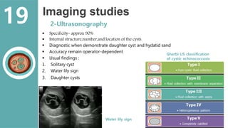 Imaging studies
2-Ultrasonography
 Specificity- approx 90%
 Internal structure,number,and location of the cysts
 Diagnostic when demonstrate daughter cyst and hydatid sand
 Accuracy remain operator-dependent
 Usual findings :
1. Solitary cyst
2. Water lily sign
3. Daughter cysts
Gharbi US classification
of cystic echinococcosis
Water lily sign
19
 