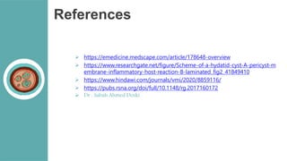 References
 https://emedicine.medscape.com/article/178648-overview
 https://www.researchgate.net/figure/Scheme-of-a-hydatid-cyst-A-pericyst-m
embrane-inflammatory-host-reaction-B-laminated_fig2_41849410
 https://www.hindawi.com/journals/vmi/2020/8859116/
 https://pubs.rsna.org/doi/full/10.1148/rg.2017160172
 Dr . Sabah Ahmed Doski
 