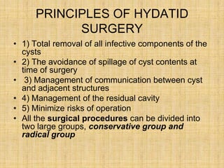 Hydatid cyst of liver by dr aakif