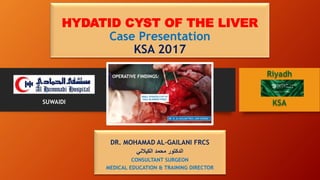 HYDATID CYST OF THE LIVER
Case Presentation
KSA 2017
DR. MOHAMAD AL-GAILANI FRCS
‫الكيالني‬ ‫محمد‬ ‫الدكتور‬
CONSULTANT SURGEON
MEDICAL EDUCATION & TRAINING DIRECTOR
SUWAIDI
Riyadh
KSA
 