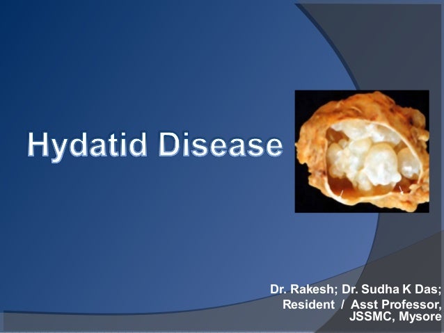 Hydatid disease