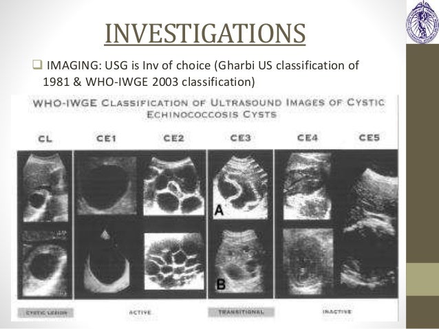 Hydatid Diseases