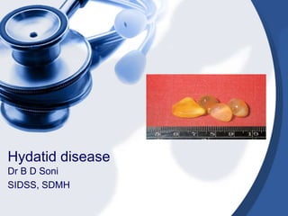 Hydatid disease
Dr B D Soni
SIDSS, SDMH
 