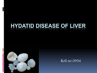 HYDATID DISEASE OF LIVER
Roll no 0954
 