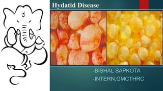 Hydatid Disease
-BISHAL SAPKOTA
-INTERN,GMCTHRC
 