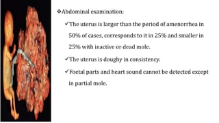 Abdominal examination:
The uterus is larger than the period of amenorrhea in
50% of cases, corresponds to it in 25% and smaller in
25% with inactive or dead mole.
The uterus is doughy in consistency.
Foetal parts and heart sound cannot be detected except
in partial mole.
 