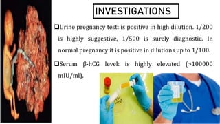 INVESTIGATIONS
Urine pregnancy test: is positive in high dilution. 1/200
is highly suggestive, 1/500 is surely diagnostic. In
normal pregnancy it is positive in dilutions up to 1/100.
Serum β-hCG level: is highly elevated (>100000
mIU/ml).
 