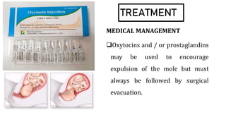 TREATMENT
MEDICAL MANAGEMENT
Oxytocins and / or prostaglandins
may be used to encourage
expulsion of the mole but must
always be followed by surgical
evacuation.
 