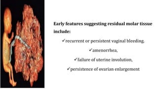 Early features suggesting residual molar tissue
include:
recurrent or persistent vaginal bleeding.
amenorrhea,
failure of uterine involution,
persistence of ovarian enlargement
 