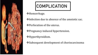 COMPLICATION
Hemorrhage.
Infection due to absence of the amniotic sac.
Perforation of the uterus.
Pregnancy induced hypertension.
Hyperthyroidism.
Subsequent development of choriocarcinoma
 