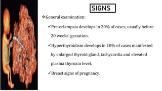 SIGNS
General examination:
Pre-eclampsia develops in 20% of cases, usually before
20 weeks’ gestation.
Hyperthyroidism develops in 10% of cases manifested
by enlarged thyroid gland, tachycardia and elevated
plasma thyroxin level.
Breast signs of pregnancy.
 