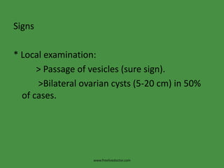 Signs
* Local examination:
> Passage of vesicles (sure sign).
>Bilateral ovarian cysts (5-20 cm) in 50%
of cases.
www.freelivedoctor.com
 