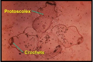 Protoscolex




        Crochets
 