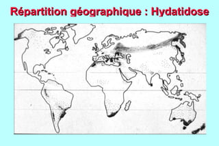 Répartition géographique : Hydatidose
 