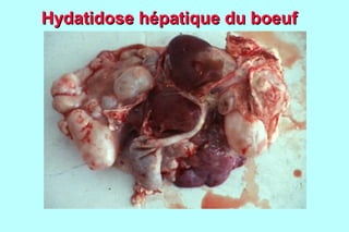 Hydatidose hépatique du boeuf
 