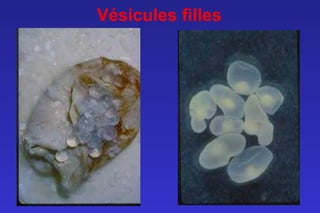 Vésicules filles
 