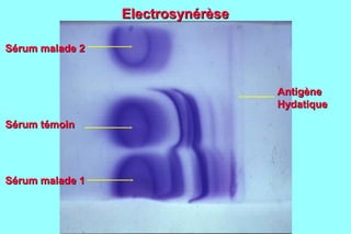 Electrosynérèse

Sérum malade 2



                                   Antigène
                                   Hydatique
Sérum témoin




Sérum malade 1
 