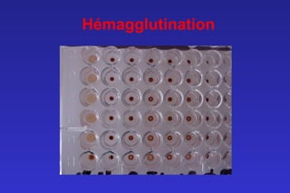 Hémagglutination
 