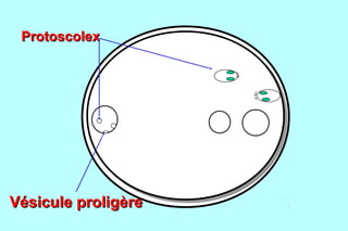 Protoscolex




Vésicule proligère
 